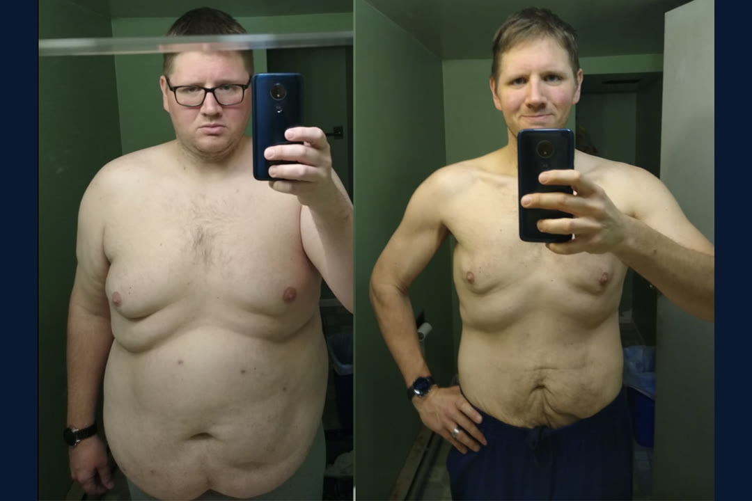 Brian N. before and after