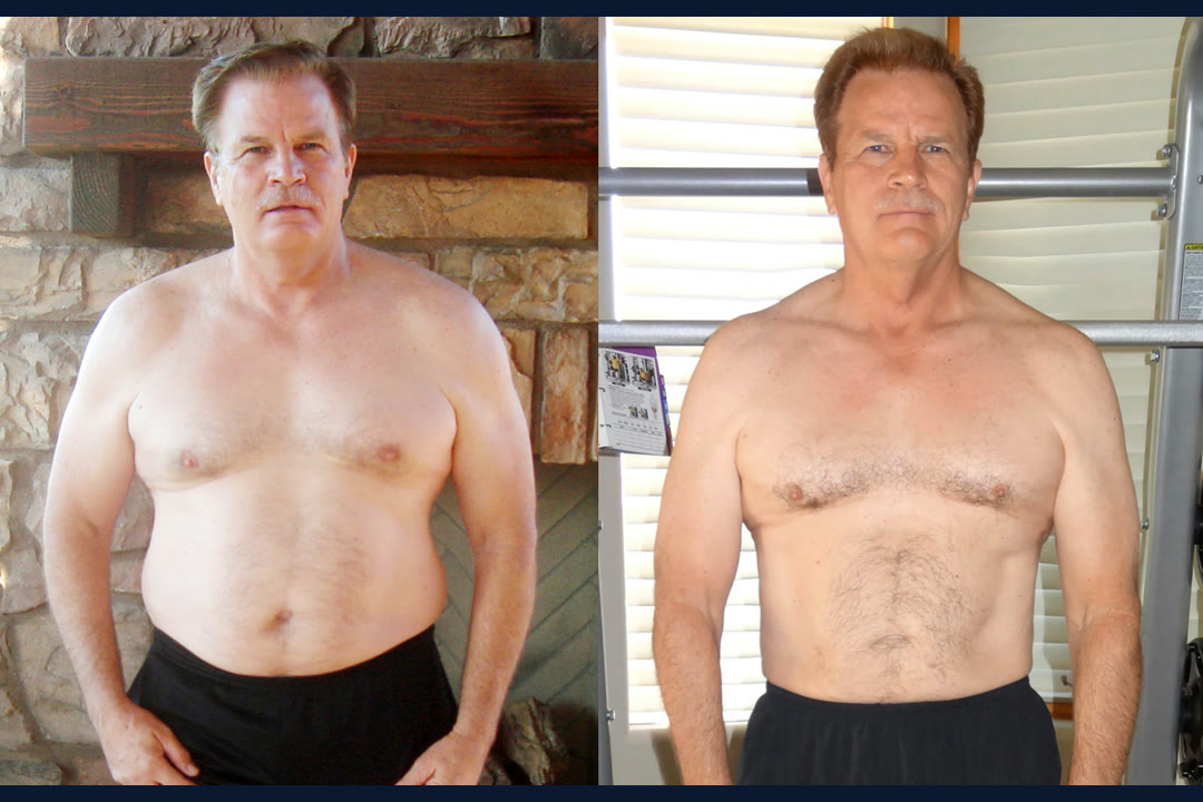 Jim Y. before and after