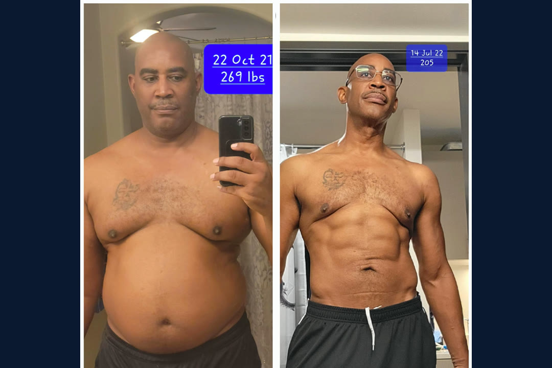 Keith V. before and after