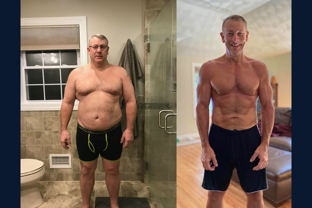 Lee S. before and after