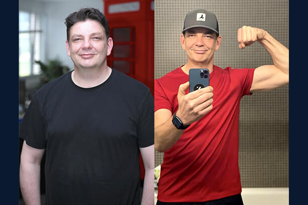 Werner M. before and after